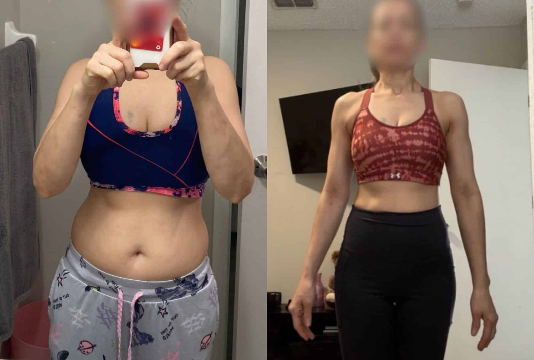 Antes y después de Ana