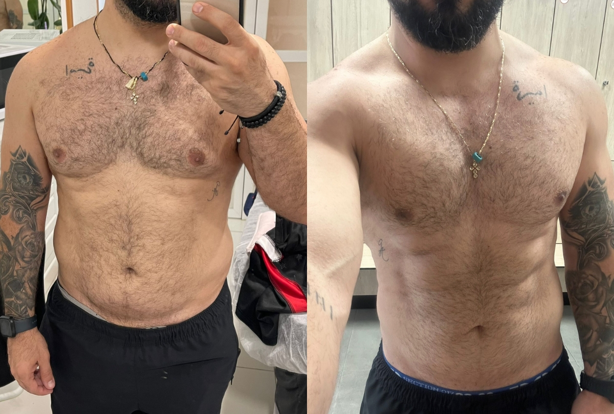 Antes y despues de un cliente
