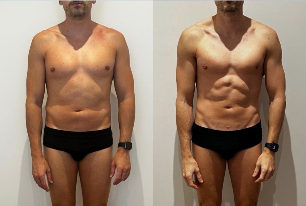 Antes y despues de un cliente
