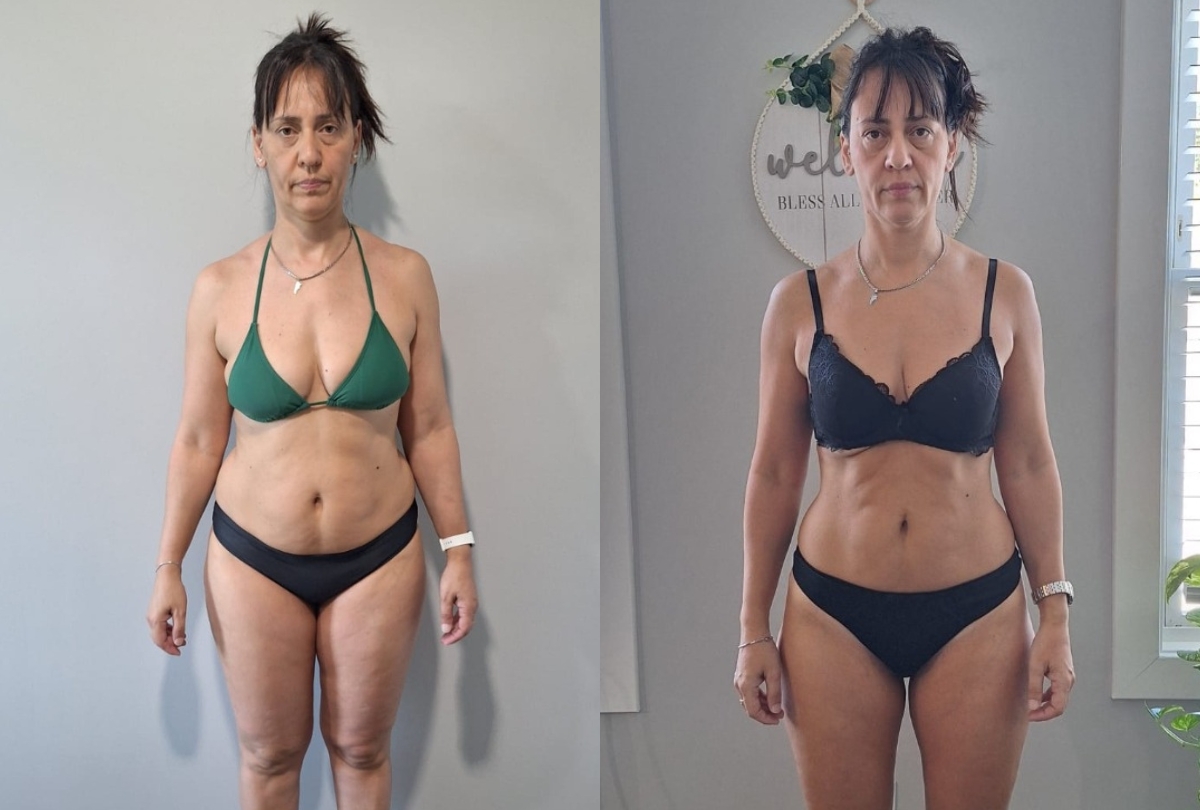Antes y despues de un cliente